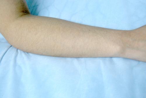 青島e光美白嫩膚整形價(jià)目表清單預(yù)覽(2023青島e光美白嫩膚參考價(jià)為：5667元)