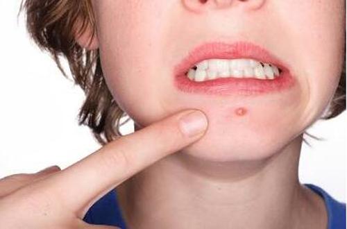 雞西肥厚鼻尖鼻翼矯正術(shù)收費價格圖表一覽(2023雞西肥厚鼻尖鼻翼矯正術(shù)參考價為：6690元)