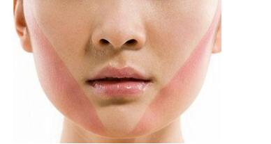 惠州激光修復(fù)細(xì)紋價(jià)格