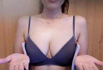 深圳激光美白治療價格