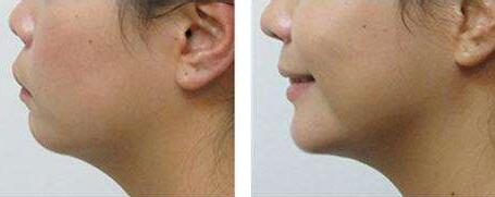 烏魯木齊激光膚色美白價(jià)位表明細(xì)參考(2023烏魯木齊激光膚色美白參考價(jià)為：6409元)