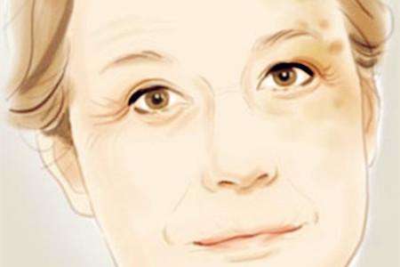 武漢臉部提拉緊致手術(shù)整形優(yōu)惠價(jià)格明細(xì)參考(2023武漢臉部提拉緊致手術(shù)參考價(jià)為：6746元)