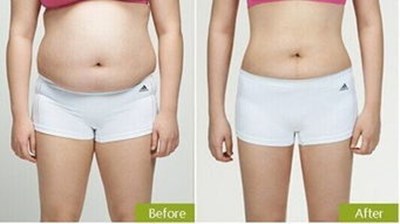 銅仁針雕祛抬頭紋價格費用查詢(2023銅仁針雕祛抬頭紋參考價為：5820元)