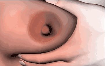 寧波韓式隆胸整形手術(shù)價(jià)格