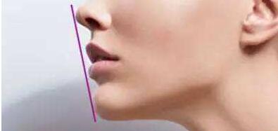 廈門溶脂針祛除雙下巴治療價目表整理(2023廈門溶脂針祛除雙下巴參考價為：6280元)