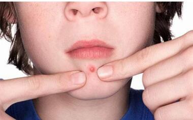 上海韓式微創(chuàng)雙眼皮大約價(jià)格一覽表(2023上海韓式微創(chuàng)雙眼皮參考價(jià)為：6244元)