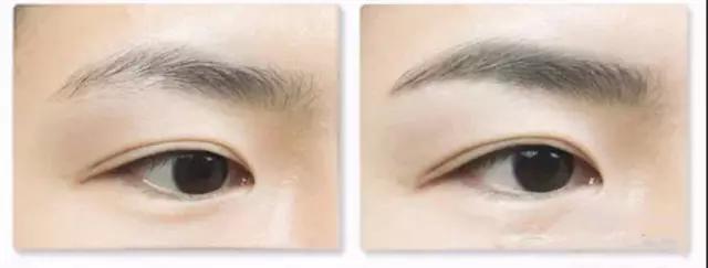 上海自體脂肪移植隆乳大概要花費(fèi)多少錢(qián)(2023上海自體脂肪移植隆乳參考價(jià)為：5969元)