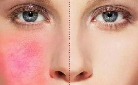 鐵嶺生物注射除皺整形價格大概多少錢(2023鐵嶺生物注射除皺參考價為：7276元)