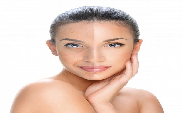 四川大拉皮去唇紋收費價格表明細剖析(2023四川大拉皮去唇紋參考價為：6570元)