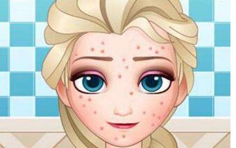 中山假體植入法隆鼻的價格震撼發(fā)布(2023中山假體植入法隆鼻參考價為：6167元)