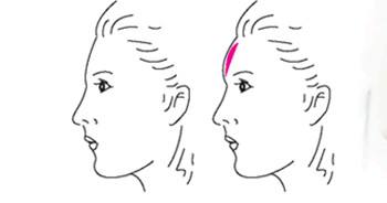 濟(jì)南冷凍法治療青色胎記2023價(jià)格表強(qiáng)勢(shì)來(lái)襲(2023濟(jì)南冷凍法治療青色胎記參考價(jià)為：6073元)
