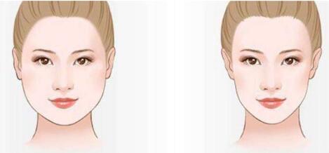 南京全臉熱瑪吉2023費(fèi)用明細(xì)全面更新(2023南京全臉熱瑪吉參考價(jià)為：6842元)