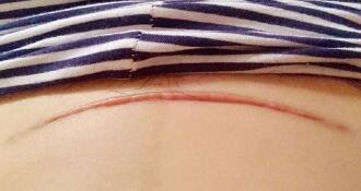 西寧鐳射凈膚祛斑王的價格是多少全新一覽(2023西寧鐳射凈膚祛斑王參考價為：7210元)