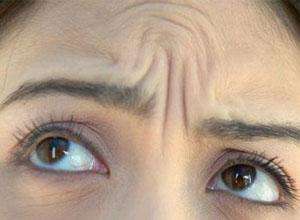 南京電波拉皮祛印第安紋的手術(shù)費(fèi)用免費(fèi)查詢(2023南京電波拉皮祛印第安紋參考價(jià)為：6790元)