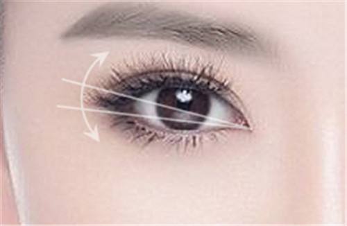 徐州疤痕激光磨削價格趨勢圖展示(2023徐州疤痕激光磨削參考價為：5507元)