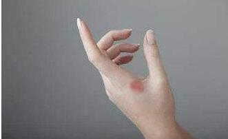 深圳乳房脫垂矯正治療價目表公示公開(2023深圳乳房脫垂矯正參考價為：6402元)