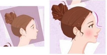 廣西背部光纖溶脂價(jià)格