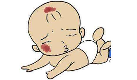 義烏自體脂肪注射動(dòng)態(tài)細(xì)紋費(fèi)用標(biāo)準(zhǔn)(2023義烏自體脂肪注射動(dòng)態(tài)細(xì)紋參考價(jià)為：6060元)