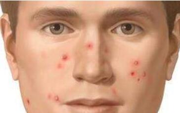 寧波皮秒去眼袋一般要治療費用是多少(2023寧波皮秒去眼袋參考價為：5272元)