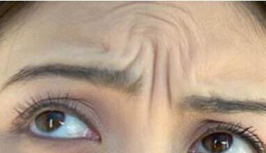 石家莊下眼袋抽脂術(shù)價格大概要多少錢(河北石家莊美萊整形美容下眼袋抽脂術(shù)參考價：4676元)