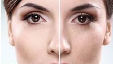 菏澤乳頭肥大價(jià)格很高嗎(2023菏澤乳頭肥大參考價(jià)為：5649元)