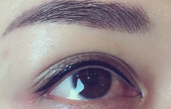 蕪湖韓式數(shù)碼雙眼皮2023收費(fèi)標(biāo)準(zhǔn)曝光(2023蕪湖韓式數(shù)碼雙眼皮參考價(jià)為：5518元)