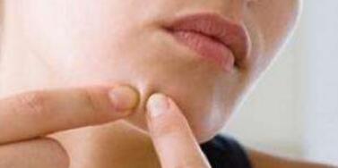 武漢熱拉提祛唇紋大概價格是多少錢(2023武漢熱拉提祛唇紋參考價為：6218元)