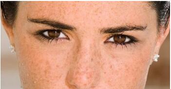 海南筋膜懸吊除皺價(jià)格