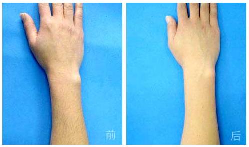 山西激光嫩膚美白手術(shù)費(fèi)用同步一覽(2023山西激光嫩膚美白參考價(jià)為：5497元)