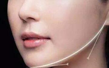 成都眼型重塑收費(fèi)價(jià)目表2023一覽(2023成都眼型重塑參考價(jià)為：6524元)