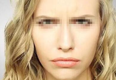 合肥微創(chuàng)手術(shù)去眼部細(xì)紋一次價(jià)格費(fèi)用是多少啊(2023合肥微創(chuàng)手術(shù)去眼部細(xì)紋參考價(jià)為：6663元)