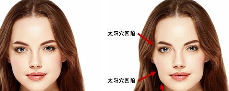 河北頸紋去除手術(shù)價(jià)格表費(fèi)用均價(jià)(2023河北頸紋去除手術(shù)參考價(jià)為：6621元)