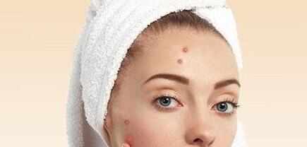 江蘇膠原蛋白祛黑眼圈大約市場(chǎng)價(jià)格是多少(2023江蘇膠原蛋白祛黑眼圈參考價(jià)為：7205元)