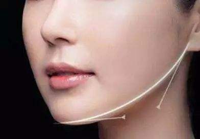 北京去妊娠紋手術(shù)費用為多少(2023北京去妊娠紋手術(shù)參考價為：6941元)