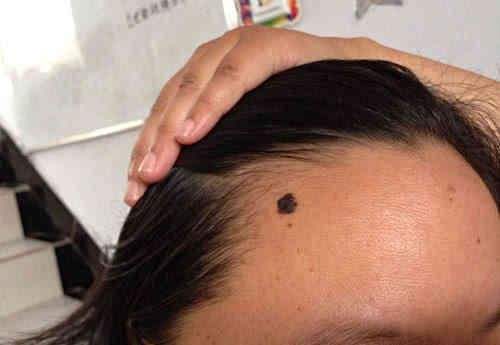 北京PRP回春術(shù)2023價(jià)格表明細(xì)公開(2023北京PRP回春術(shù)參考價(jià)為：5704元)