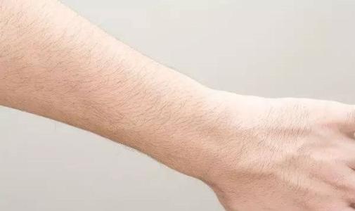 上海眼尾紋除皺針一般要費(fèi)用多少錢(qián)(2023上海眼尾紋除皺針參考價(jià)為：5772元)