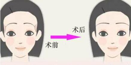 阜陽(yáng)塑美極價(jià)格