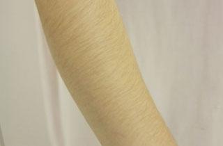 南京熱瑪吉去眼紋治療價位預(yù)覽(2023南京熱瑪吉去眼紋參考價為：5675元)