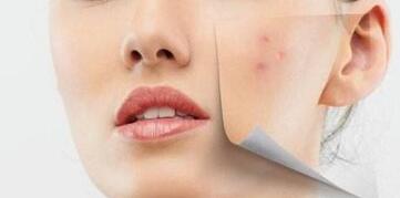 武漢印第安紋注射的費用多少錢明細(2023武漢印第安紋注射參考價為：6083元)