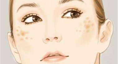 常州凹陷疤痕玻尿酸填充平均費用范圍(2023常州凹陷疤痕玻尿酸填充參考價為：6615元)