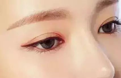 泉州蘋果肌下垂提升術(shù)價目表查看(2023泉州蘋果肌下垂提升術(shù)參考價為：6648元)