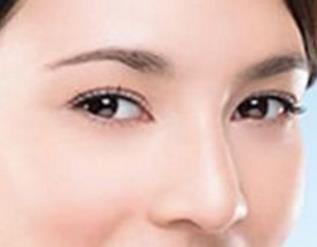 武漢填充祛眼角紋大概要手術(shù)多少錢(2023武漢填充祛眼角紋參考價為：5754元)