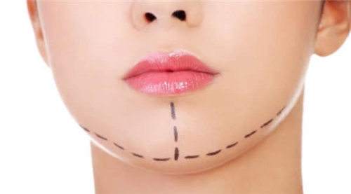 北京水光針注射的手術(shù)費(fèi)用一般需要多少錢(北京壬九馨康門診水光針注射參考價(jià)：4818元)