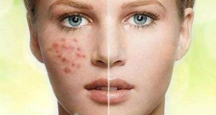 廣州精致雙眼皮手術(shù)大致需要花多少錢(2023廣州精致雙眼皮手術(shù)參考價(jià)為：6763元)