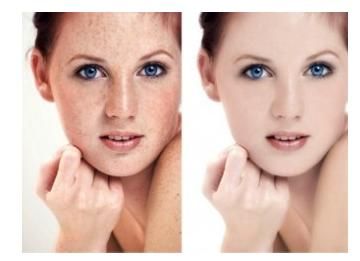 重慶玻尿酸填充淚溝術(shù)2023收費標準免費查詢(2023重慶玻尿酸填充淚溝術(shù)參考價為：6412元)