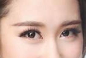 成都眼睛細紋打活細胞價目表線上更新(2023成都眼睛細紋打活細胞參考價為：5672元)