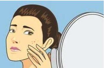 深圳m22激光祛痘印價格