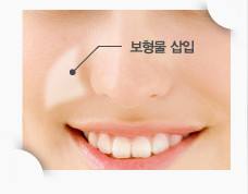 廣西鐳射c10祛斑治療價目表瀏覽(2023廣西鐳射c10祛斑參考價為：5663元)