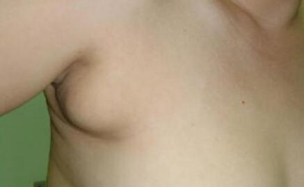 南寧消除法令紋術(shù)價(jià)位表清單分享(2023南寧消除法令紋術(shù)參考價(jià)為：7235元)