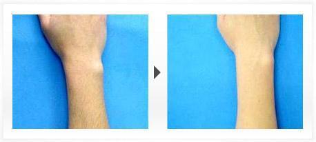 烏魯木齊干細(xì)胞精雕價(jià)格